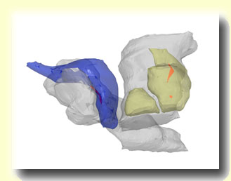 Large bouton 3D